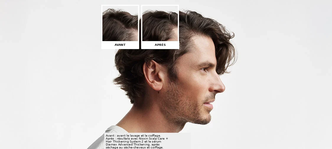 Nioxin System Kit 2 before and after image
