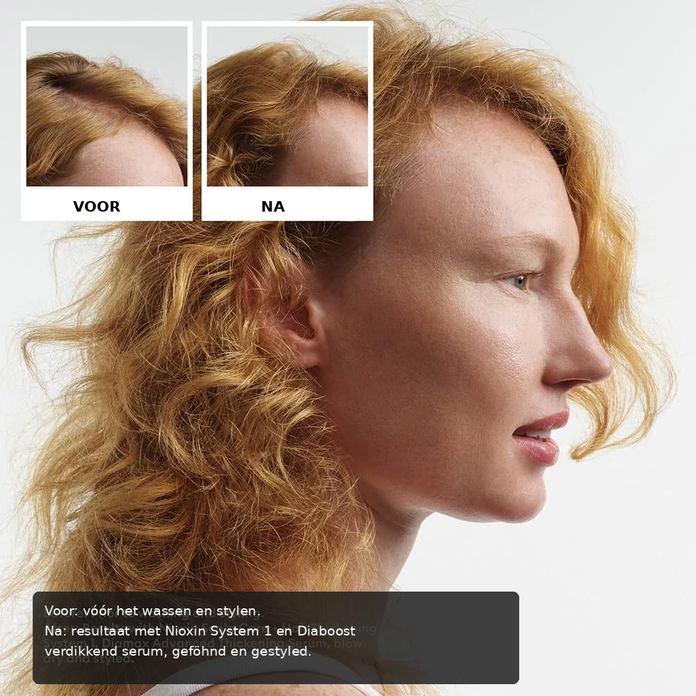 Nioxin System Trial Kit 1 before and after image