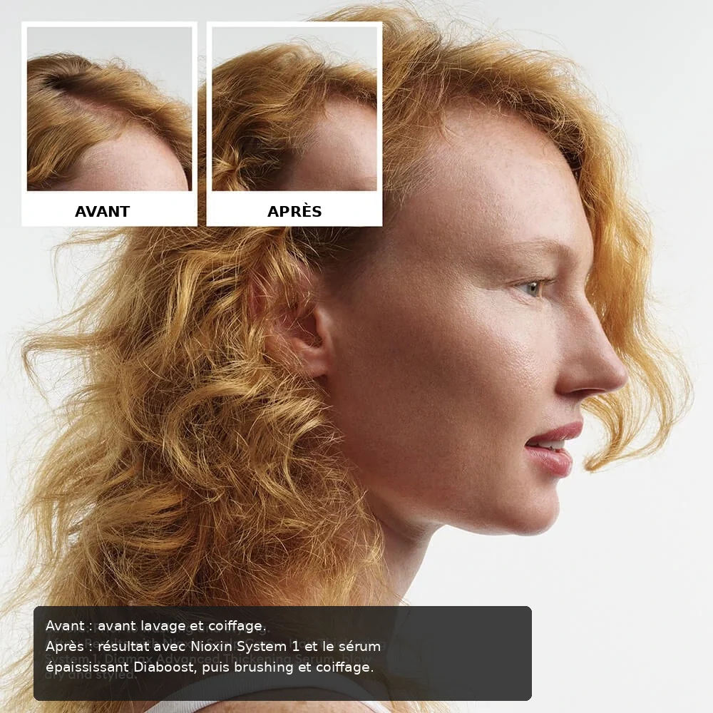Nioxin System Trial Kit 1 before and after image