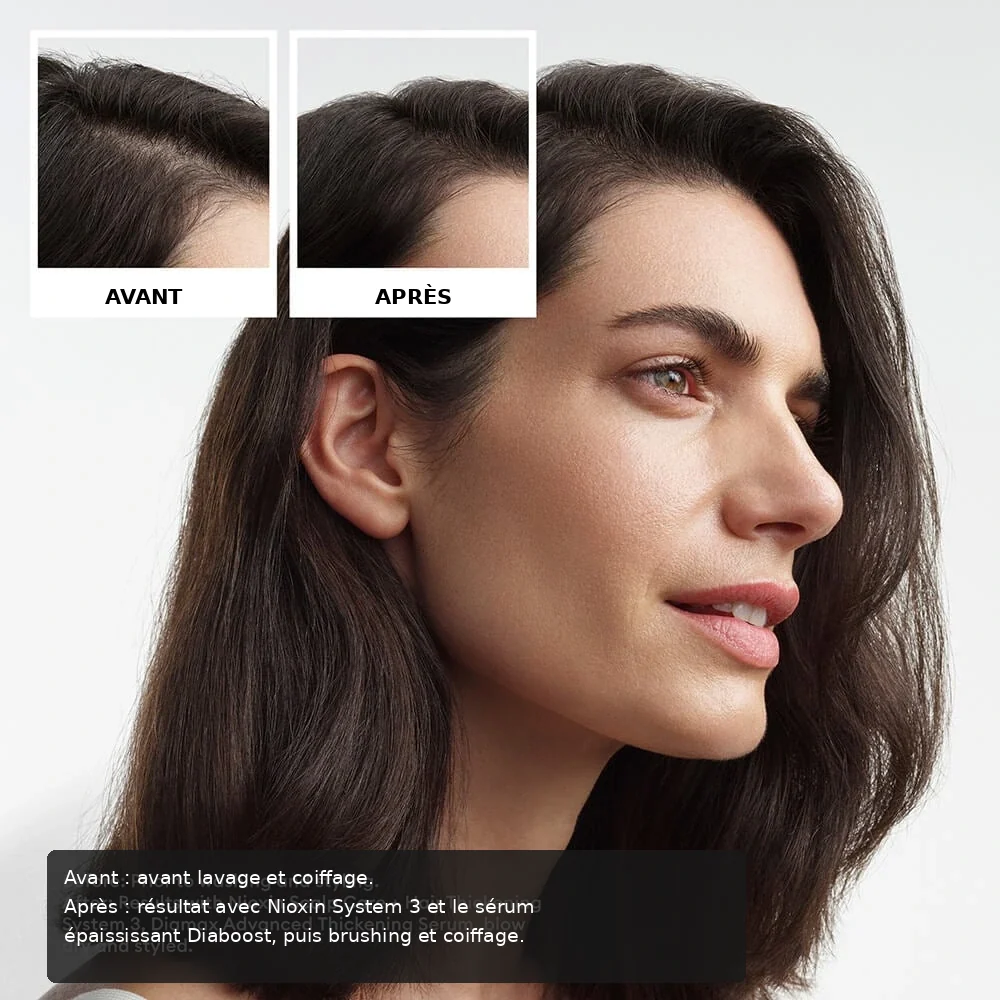 Nioxin System Trial Kit 3 before and after image