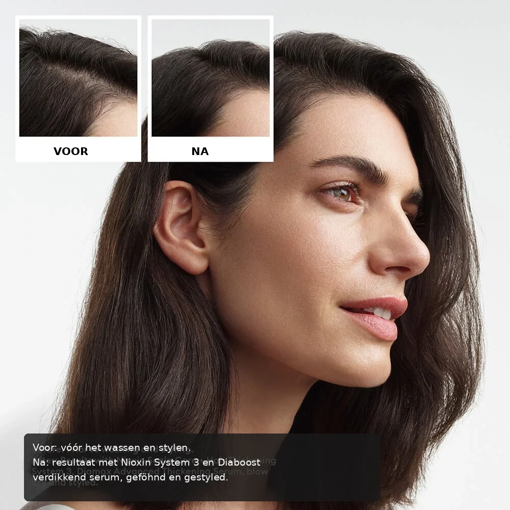 Nioxin System Trial Kit 3 before and after image